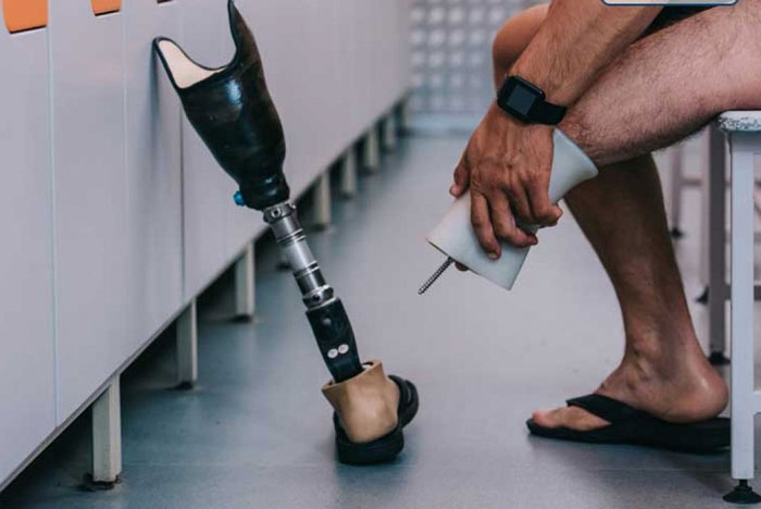 پای مصنوعی هوشمند زیر زانو