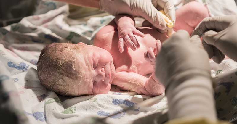 صافی پشت سر نوزاد هنگام تولد